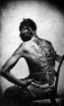 Cicatrices de flagellation sur un esclave.jpg